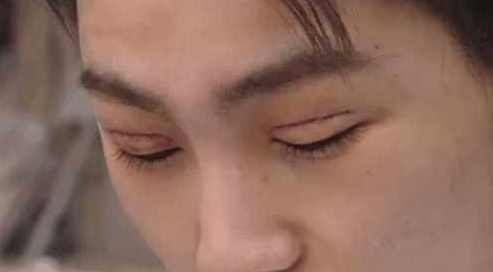 小傅|小伙为了变得更加帅气去割双眼皮,割完之后他的人生都发生了变化