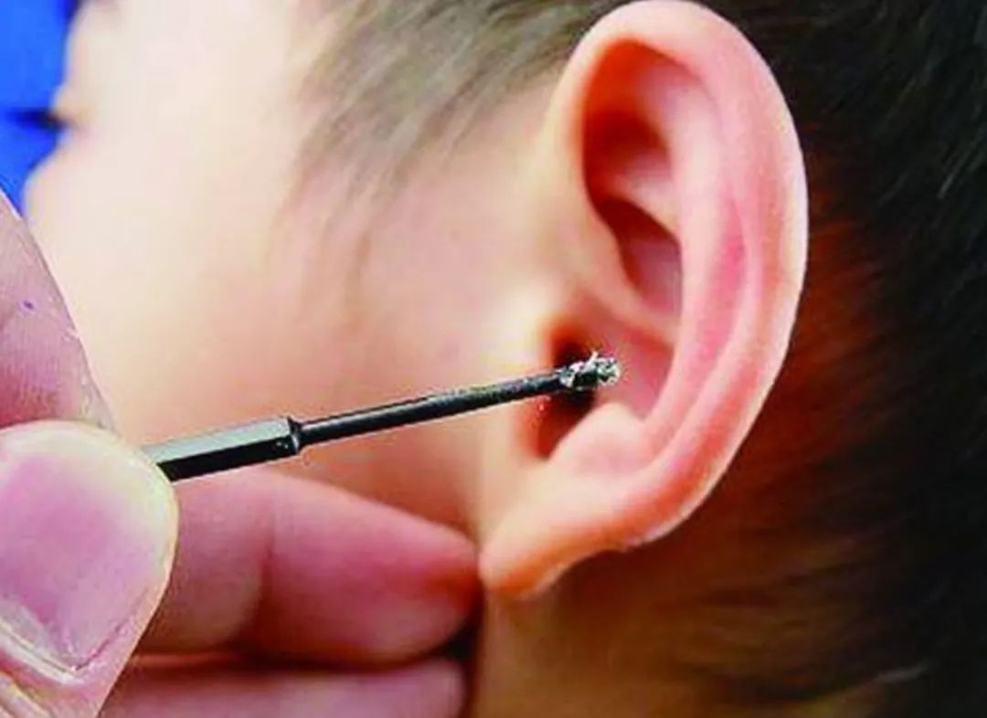 液体|娃耳朵进虫子,妈妈果断地处理方式救了孩子的听力,连医生都夸赞