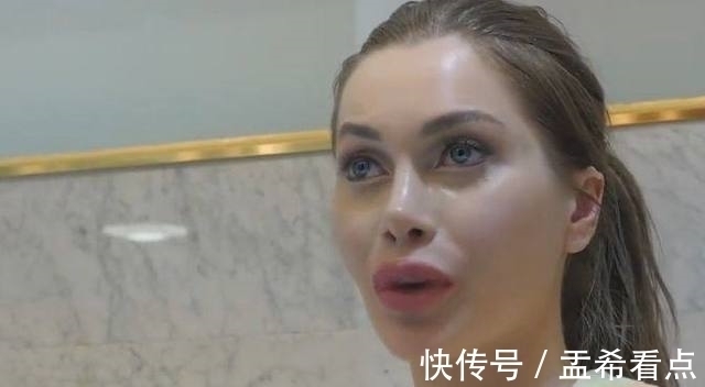 整形手术 美国一女子去韩国做危险极高的额骨手术，还说整容上瘾