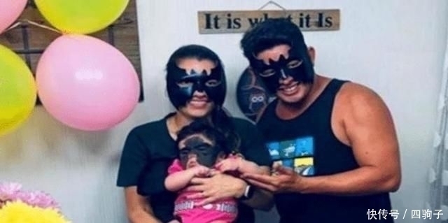 胎记|当年做8次整容手术,让人印象深刻的“蝙蝠侠女孩”,后来怎么样