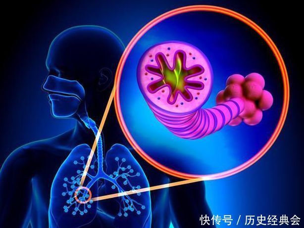 肺癌|肺气肿和肺癌在症状和临床上有什么区别,为健康,应该了解下