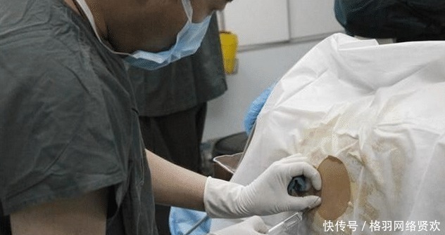 卤猪肉|生孩子遇到“段子手”医生,笑点低的产妇,没打麻药都能笑得出来