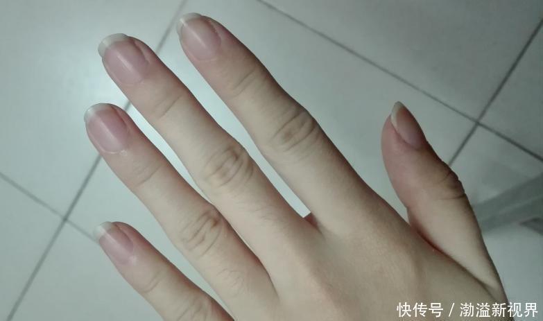科学|指甲上没有月牙与指甲上有的人，谁身体更健康科学的解释来了