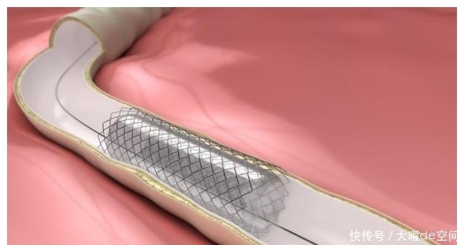 “過度醫療”或被曝光:很多手術或不該做,很多藥也不該吃