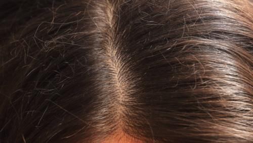 头发是从发根长，还是从发梢长？头发掉了，还会长出来吗？