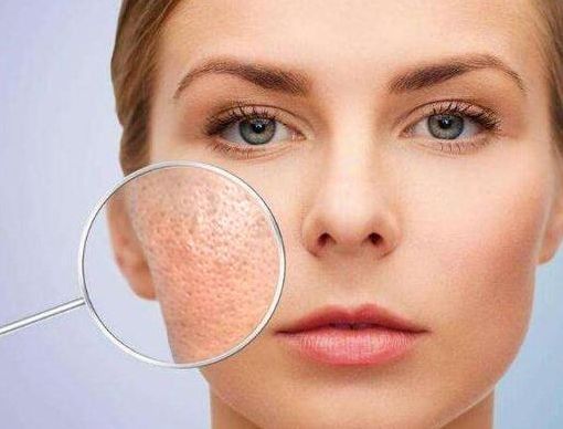 毛孔粗大？赶紧试试这个办法！