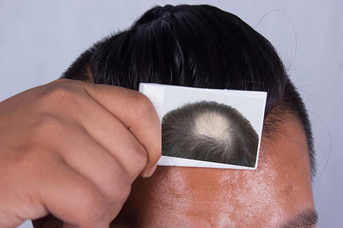 营养物质|男性荷尔蒙不足会有哪些表现?第二点太尴尬,注意补充