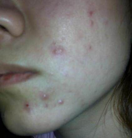 皮肤日常的护理与改善