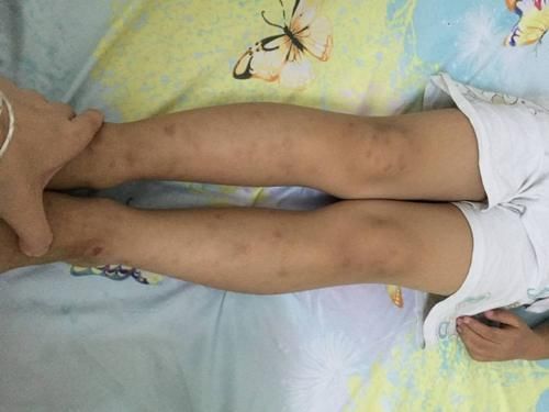 孩子|孩子身高进入猛涨期,会出现“特殊征兆”,错过了容易影响长个