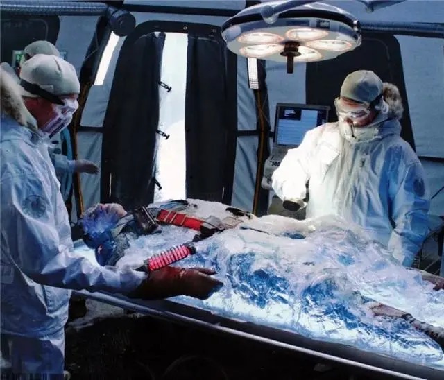 黄梅戏&我国首例女冷冻人,打算50年后“复活”,如今结果怎么样了