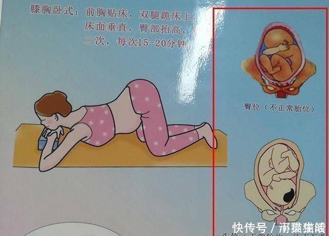 宝妈|头胎选择剖腹产,二胎可以顺产吗?若孕妈是这三种情况,就别想了
