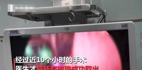 纽扣电池|两岁宝宝总是肚子痛还经常吐绿水,带去医院检查后,妈妈崩溃了……