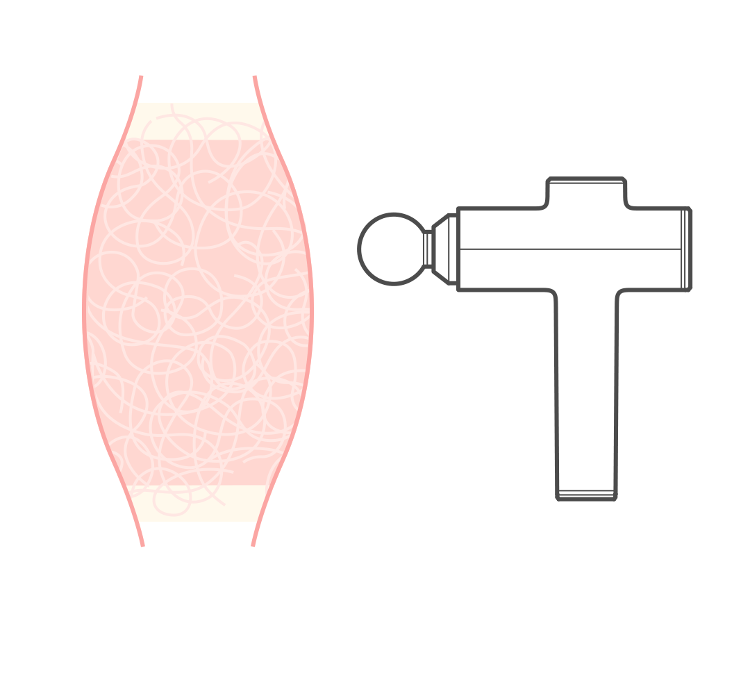 头痛|胆真大!68岁阿姨用筋膜枪给眼睛按摩,结果惨了