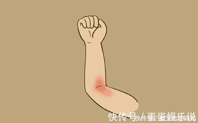 宝宝|宝妈以为新生宝宝身上的是朱砂痣,被网友着急评论:赶紧送医院