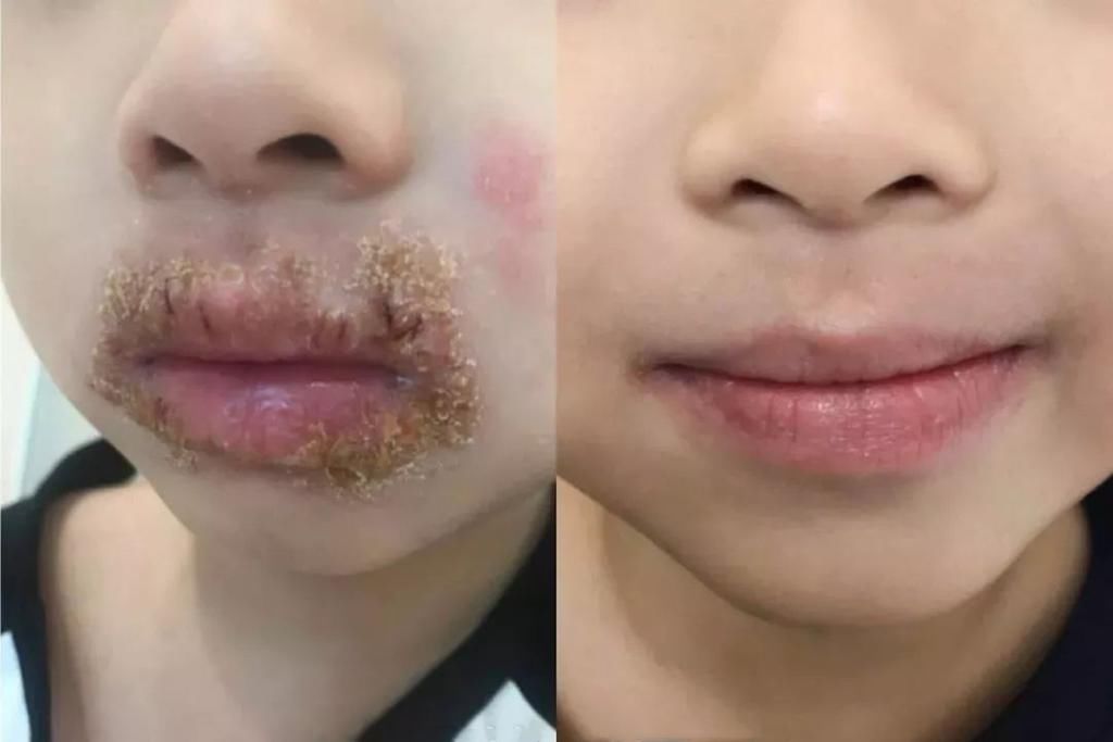 自查|因为1个习惯动作，5岁男童被抽血4次，这个安全隐患宝妈快自查