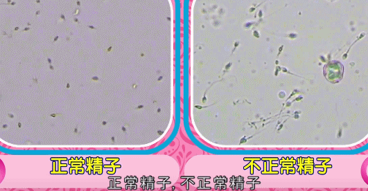 生育力|身体健康≠精子健康,这些习惯易致男性不育,日常要谨慎了!