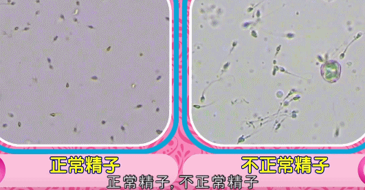 生育力|身体健康≠精子健康，这些习惯易致男性不育，日常要谨慎了！
