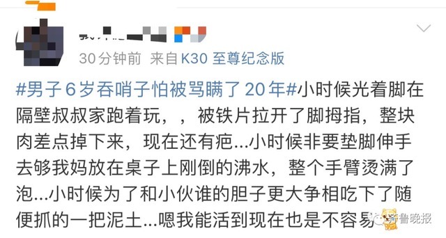 海姆立克法|男子6岁时吞了个……怕被家长骂,竟瞒了20年