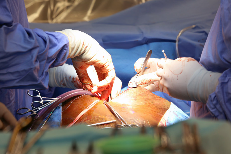 脑梗|患上冠心病后,如果平时有个细节没注意,很容易导致猝死