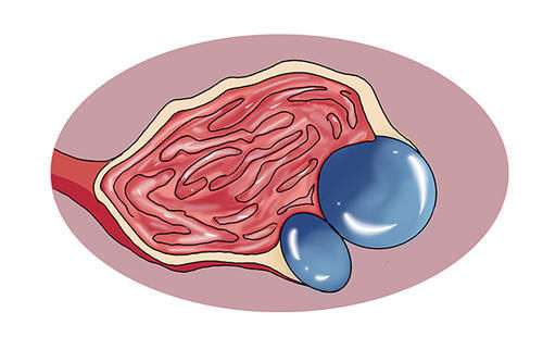 乳腺增生|绝经只有坏处,没有任何好处?医生:绝经后,3个好处可获得