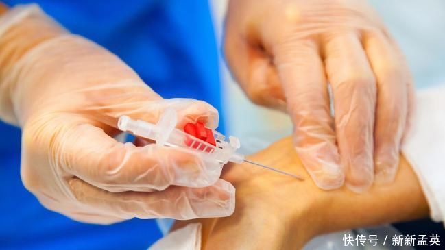 血管堵塞|老年人血管抵抗力下降，不妨做好4件事，让血管恢复弹力，不淤堵