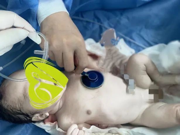 产科|孕晚期女子,胎动消失15小时!紧急手术