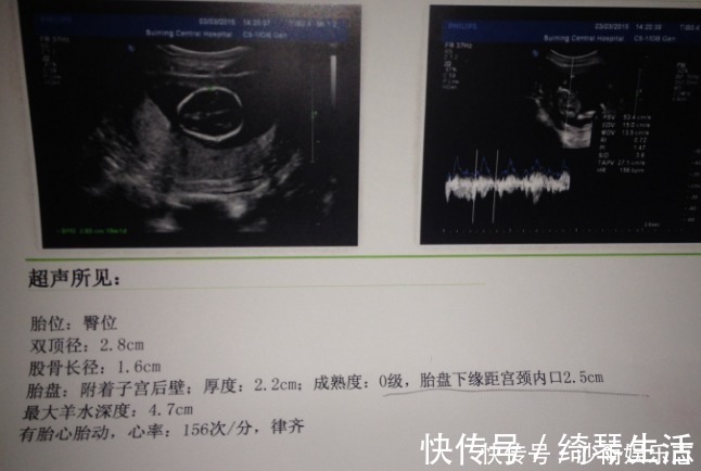 宝宝|孕期，孕妈做四维彩超若有这些信号，怀男孩的可能性大吗