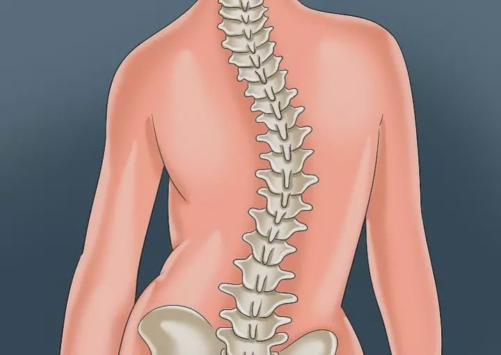 脊柱侧凸|孩子“高低肩”“长短腿”？需要警惕这个病……