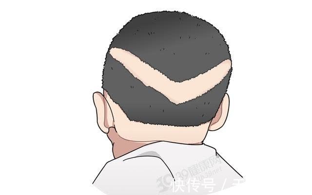 x型腿|原来喝骨头汤不补钙?教你正确的4个补钙方法,附6种高钙蔬菜