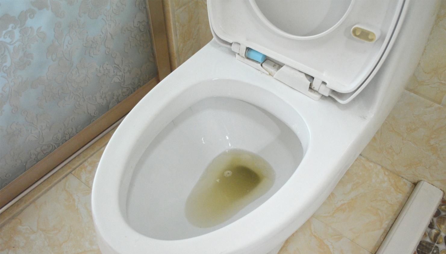 把这2样东西放进马桶里, 马桶不刷也不会脏臭, 看完赶紧去试试