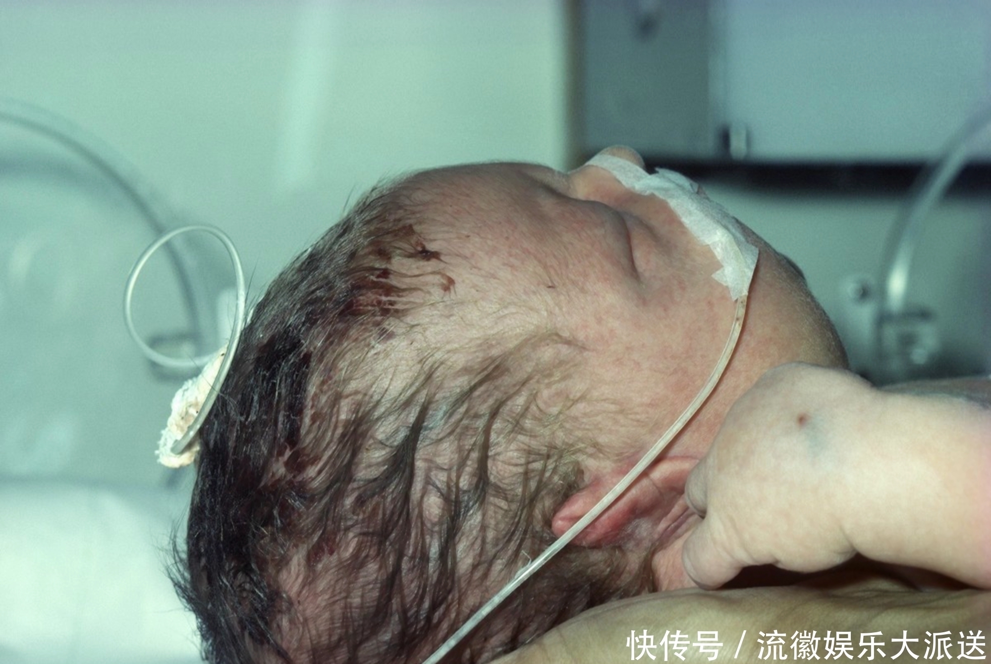 溶血症|妈妈是这种血型,宝宝出生就“赢了”,四方面优势一目了然