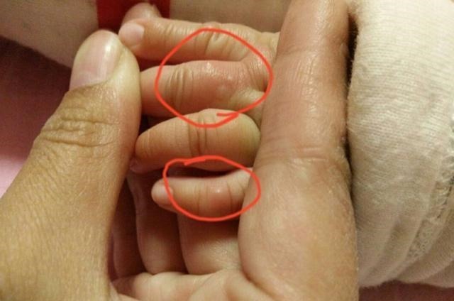 婴儿|孩子聪明不聪明,看看小手就知道,智商的高低手掌上就有信号