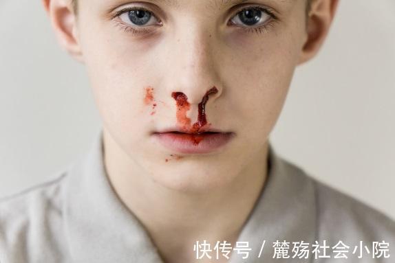 肝功能检查|经常放屁的人，身体出现4个症状，说明肝脏生病了，早查肝CT