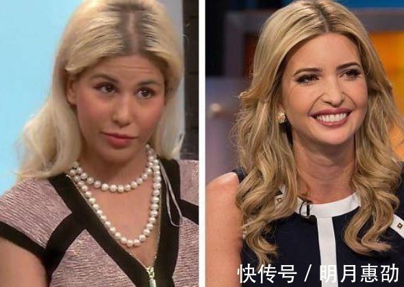 整容手术|女子花重金整容,一年经历13次整容手术,整容前后判若两人