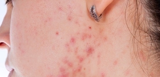 耳根|内科主任提醒:肝不好的人,少吃这3种蔬菜,肝或许越来越坚强