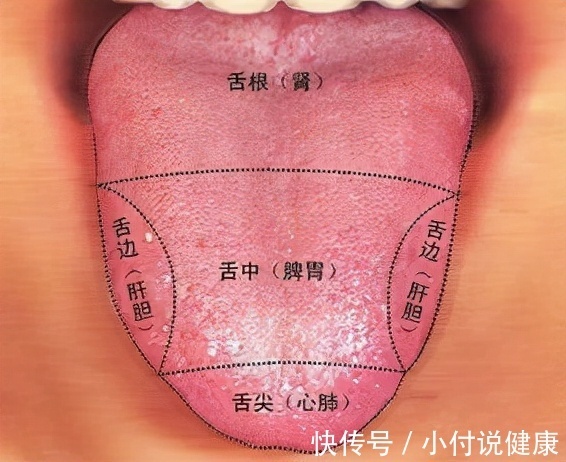 舌尖红心火旺，舌边红肝火旺，舌全红胃火旺，送你简单应对方法