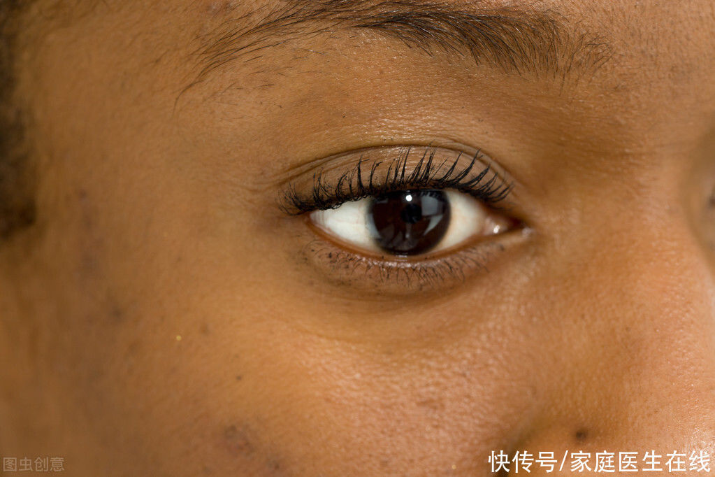 大蒜|大蒜是肝脏的“发物”?想养护肝脏,这3种食物要少吃,真的很伤肝