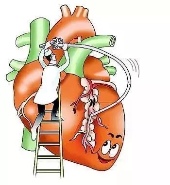 冠心病|按揉这三个穴位,拯救心脏健康!