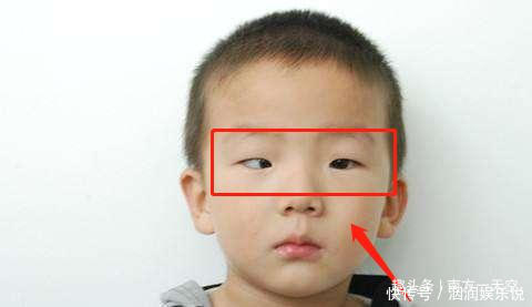 电子产品|5岁男童老玩这类玩具,导致黑眼珠逐渐“消失”,家长要注意