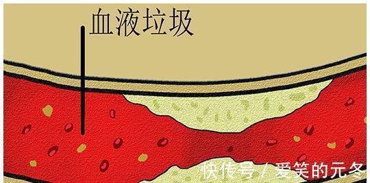 人体|身上两个部位隐隐疼痛，或是血脂偏高的求助信号，别再视而不见