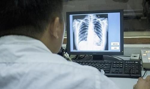 妇科检查|女人做胸透时,医生会看到什么不要不好意思,看就会明白