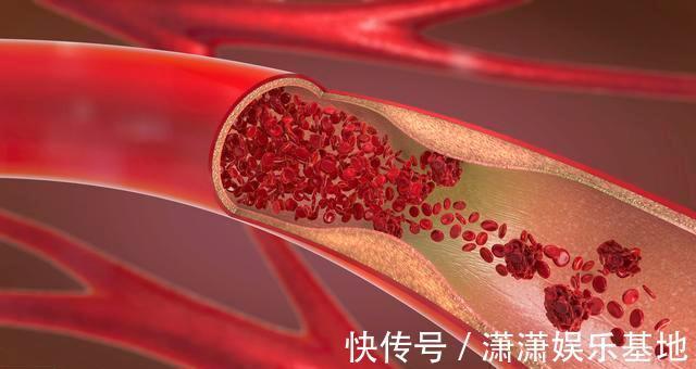 肠道健康|50岁,是寿命“决定期”,若身体有5个表现,恭喜是长寿体质