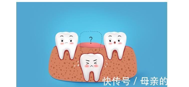 换牙|宝宝多大换牙?换牙期应注意什么?请收好这攻略!