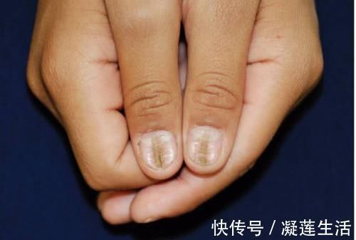 身体|肺病最怕“拖”,一旦身体出现3种迹象,可能是肺在向你“求救”