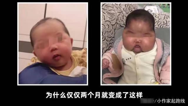 生产商|宝宝霜致一婴儿变成“大头娃娃”,只因内含激素,生产商拒不承认
