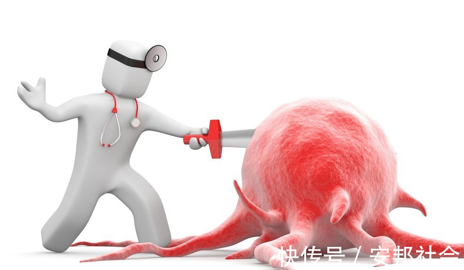 根治性|明明是肺癌早期做了根治性手术，不久就复发转移了，到底什么原因