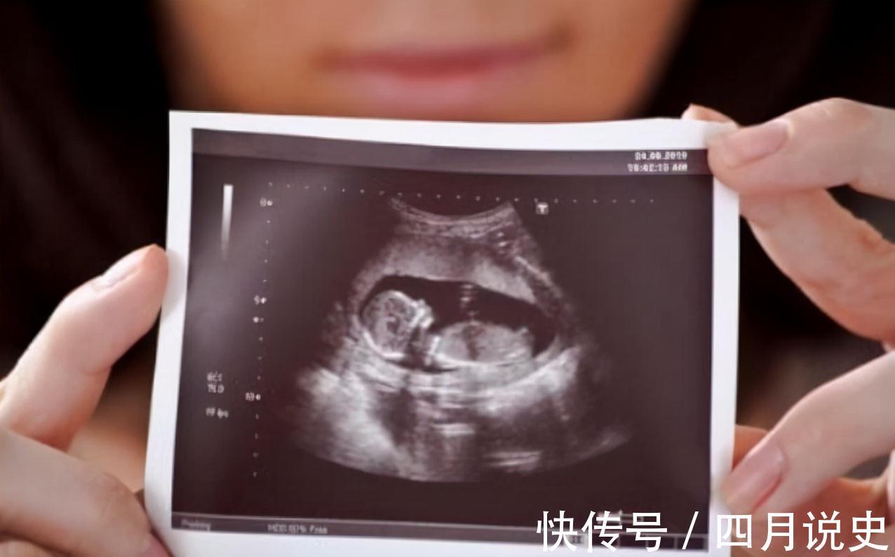 准妈妈|容易“胎停”的准妈妈,怀孕前后都有哪些特点?牢记在心别触底线
