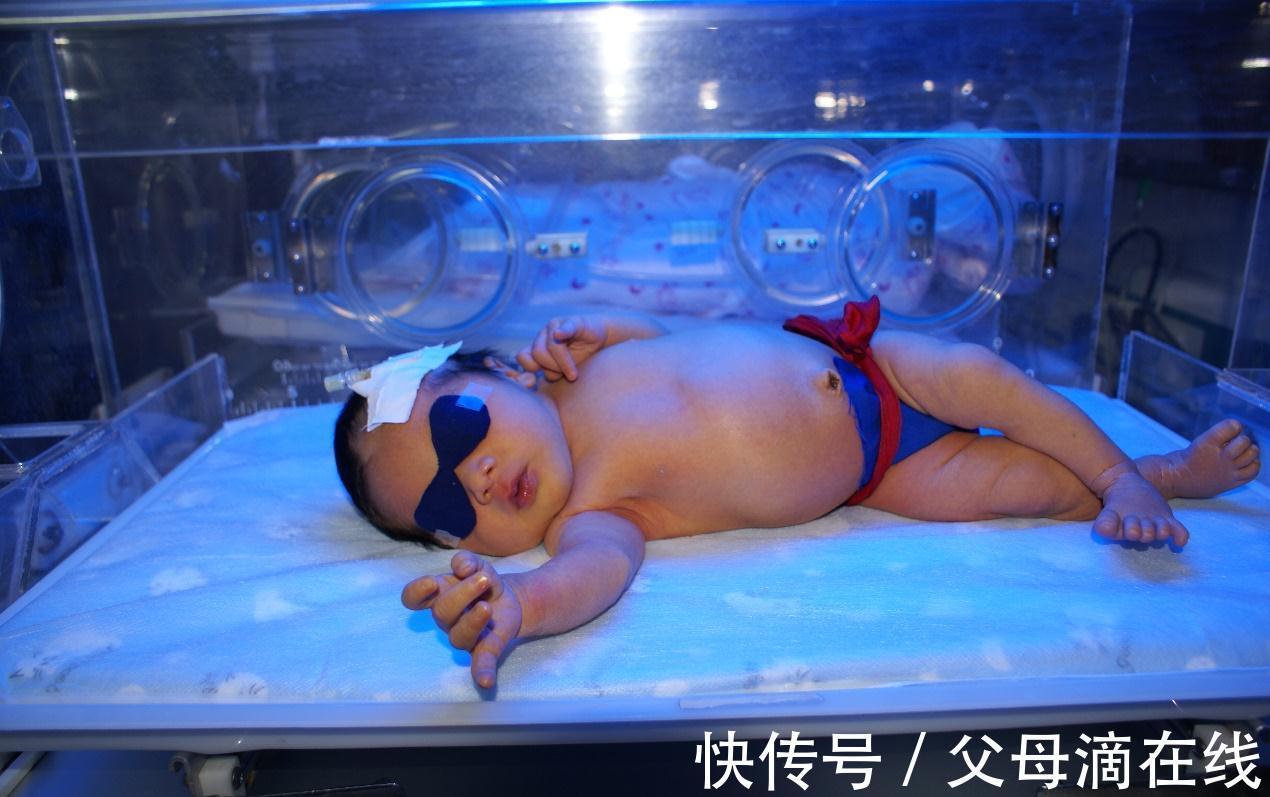 新生儿|孕期这三类食物吃得越多,宝宝出生后黄疸越明显,为了宝宝忍一忍