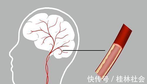 氧气|头晕乏力,可能脑供血不足身体出现异常表现,不能再拖