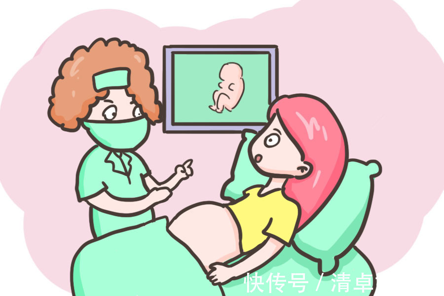 孕晚期|孕晚期最后一个月，每次做产检时，孕妈们最好问清楚这三个问题！